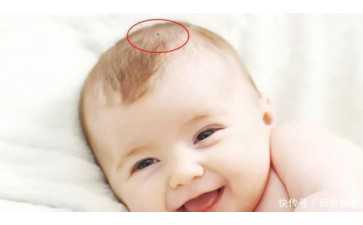 2026年供卵包男孩价格参考：环孢素在美国试管婴儿辅助生殖中的临床作用与费用解析