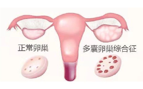 试管婴儿期间服用坤泰胶囊是否能促进卵泡快速发育